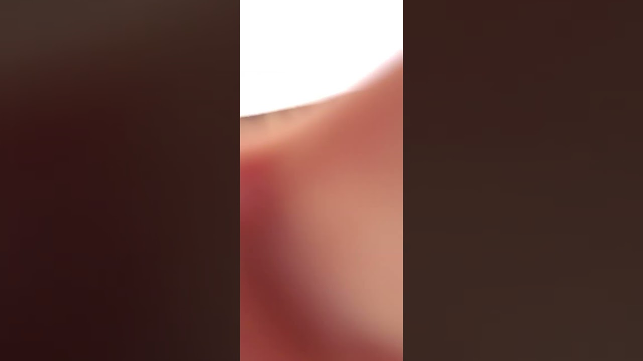 צילום ביוב קו ביוב שבור אבי אלמשלי